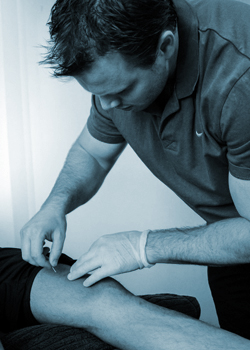 dry needling melbourne