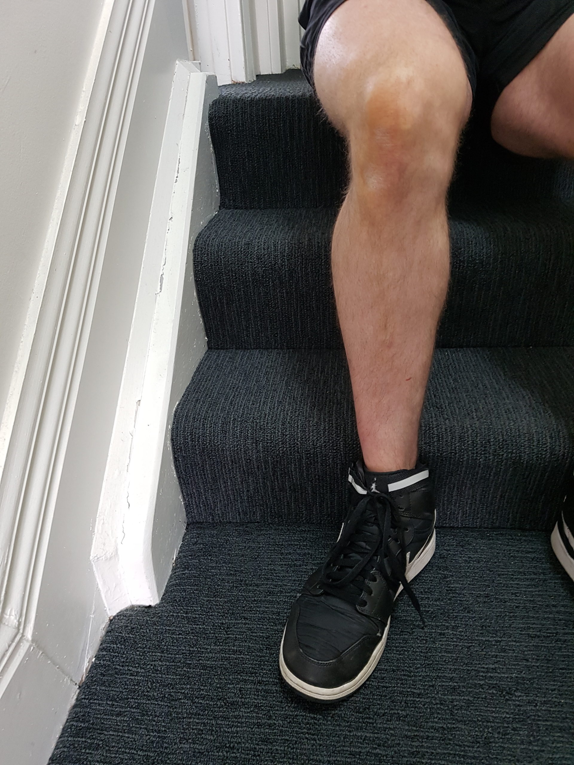 A close-up of a person sitting on stairs, highlighting the focus on joint health and mobility, relevant to massage therapies offered in Docklands.