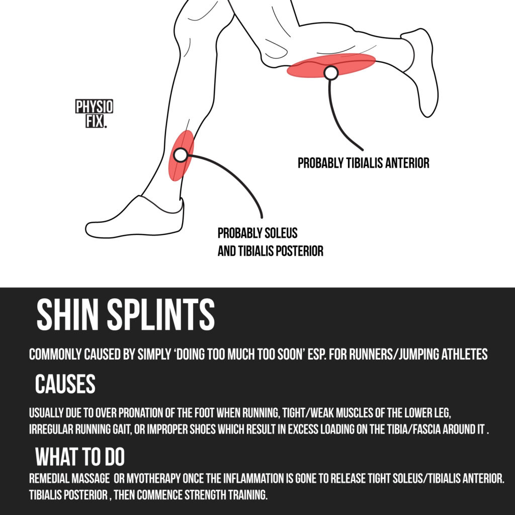 Benefits of Remedial Massage for Shin Splints | Melbourne Myotherapy