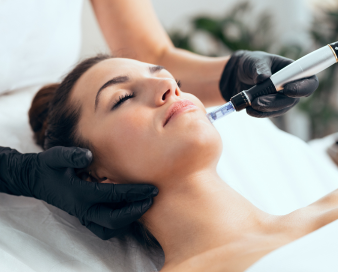 A woman receiving microneedling treatment, showcasing the precision and therapeutic touch that parallels the approach used in Melbourne trigger point therapy.