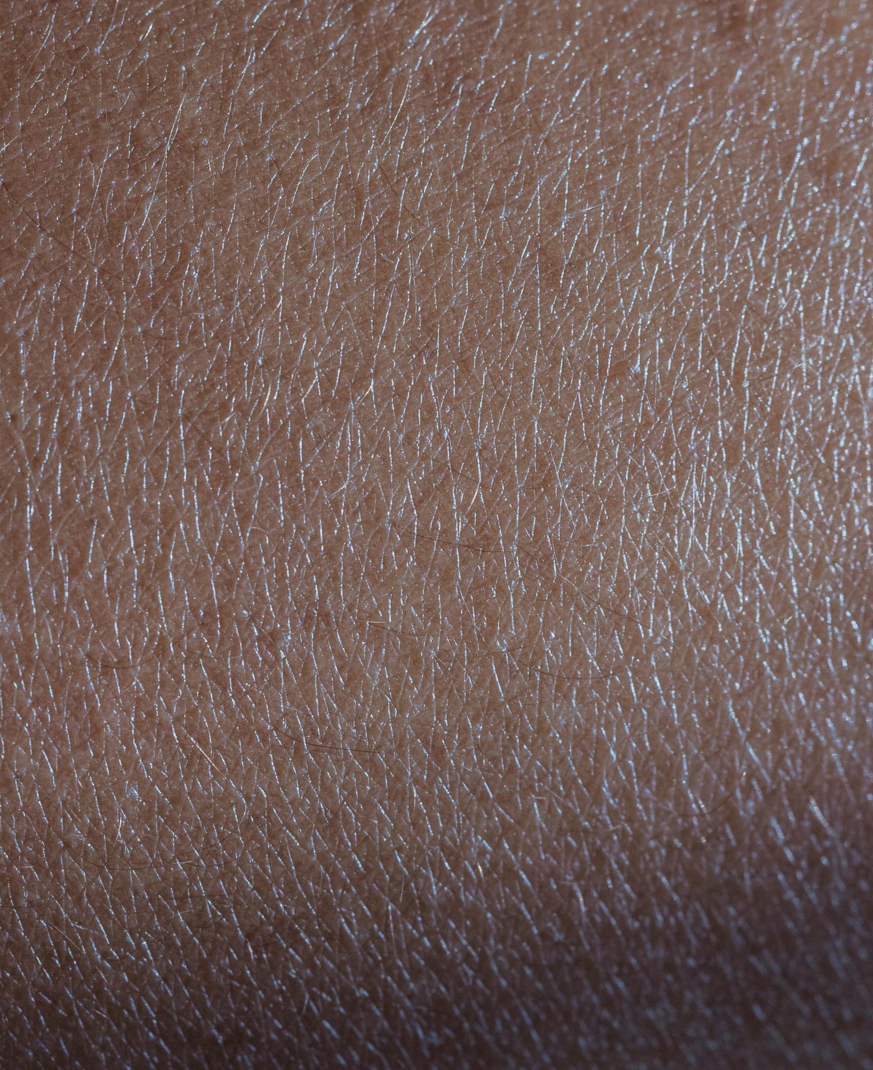 A detailed image of skin texture, symbolizing the deep pressure applied during trigger point therapy in Melbourne, targeting tight muscle areas.